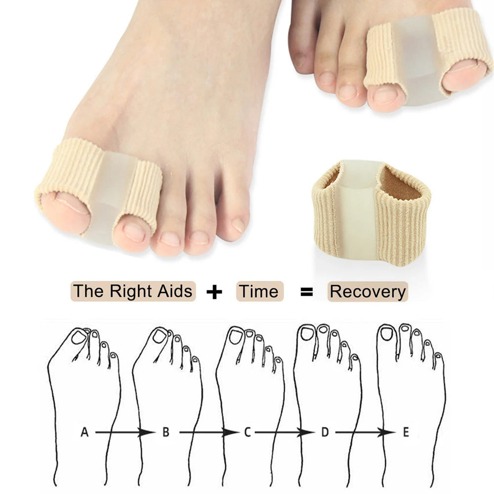 2PCS Bunion Corrector Toe Splints & Hallux Valgus Separators.